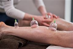Dry needling